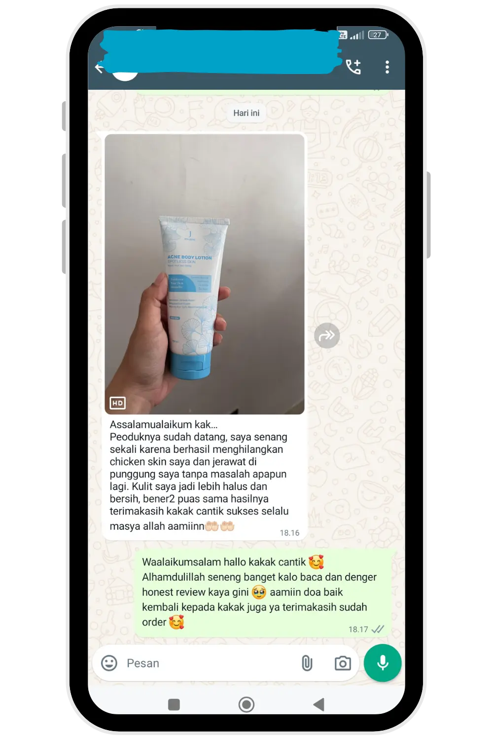 Testi-ABL-1
